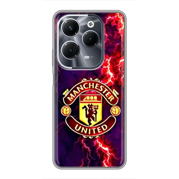 Чехол с принтом «огненный Манчестер» для Infinix Hot 40 Pro Чехол с принтом «огненный Манчестер» для Infinix Hot 40 Pro