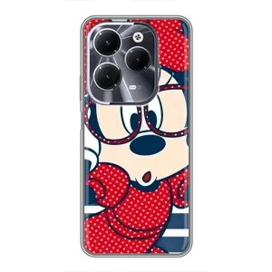 Эксклюзивный чехол для Infinix Hot 40 (AlphaPrint - Мультяшные) (Маус в очках)