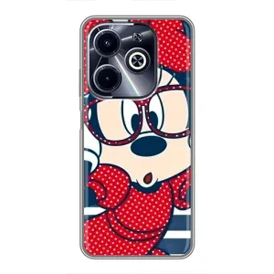 Эксклюзивный чехол для Infinix Hot 40i (AlphaPrint - Мультяшные) (Маус в очках)