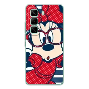 Міккі Маус чохол для Infinix Hot 60 Pro (AlphaPrint - Мультяшні) (Маус в окулярах)