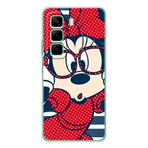 Міккі Маус чохол для Infinix Hot 60 (AlphaPrint - Мультяшні) (Маус в окулярах)