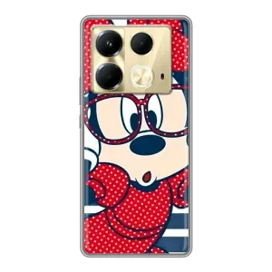 Эксклюзивный чехол для Infinix Note 40 (AlphaPrint - Мультяшные) (Маус в очках)
