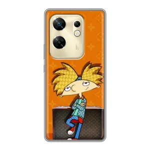 Брендновые Чехлы для Infinix Zero 30 - (PREMIUMPrint) (Арнольд)