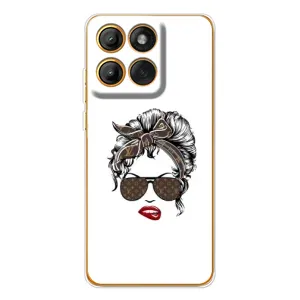 Чехлы Луи Витон для Motorola MOTO G86 (AlphaPrint - LOUIS VUITTON) (стильная с луи витон)