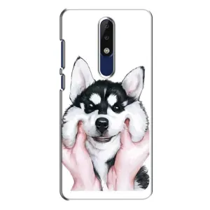 Чохол з Хаскі Nokia 5.1 Plus (X5) - (AlphaPrint) (Хаскі улибака)