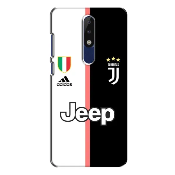 Чохол з принтом «Juventus» для Nokia 5.1 Plus (X5)