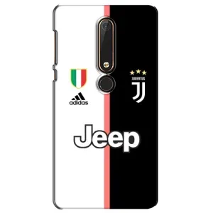 Чохли для Nokia 6 2018 (VPrint) - Футбольні клуби (Juventus)