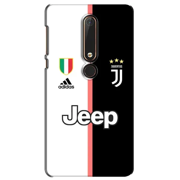 Чехол с принтом «Juventus» для Nokia 6 2018