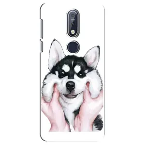 Чехол с Хаски для Nokia 7 2018, 7.1 - (AlphaPrint) (Хаски улыбака)