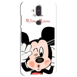 Эксклюзивный чехол для Nokia 8.1 , Nokia 8 2018 (AlphaPrint - Мультяшные) (Маус Микки)