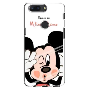 Эксклюзивный чехол для One Plus 5T (AlphaPrint - Мультяшные) (Маус Микки)