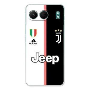 Чохли для OnePlus Nord 4 (VPrint) - Футбольні клуби (Juventus)