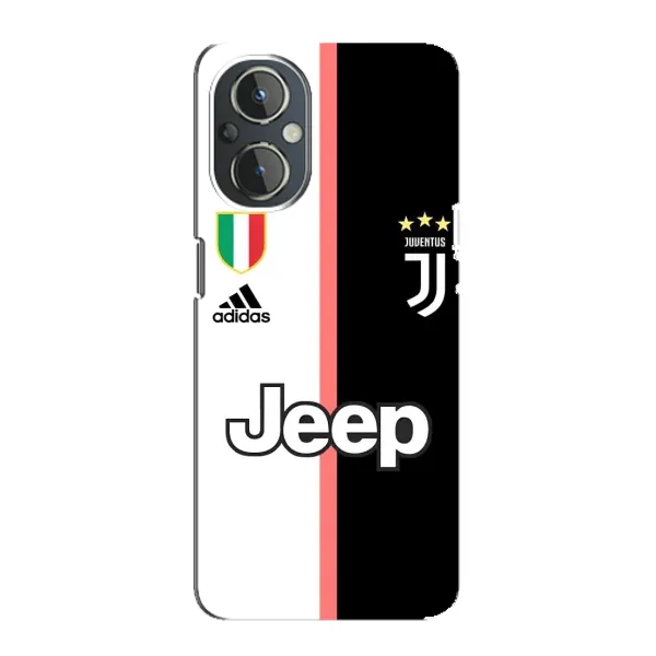 Чохол з принтом «Juventus» для OnePlus Nord N20