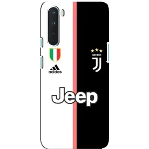 Чехлы для OnePlus Nord (VPrint) - Футбольные клубы (Juventus)