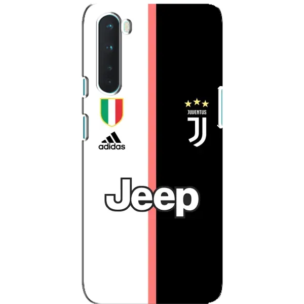 Чохол з принтом «Juventus» для OnePlus Nord