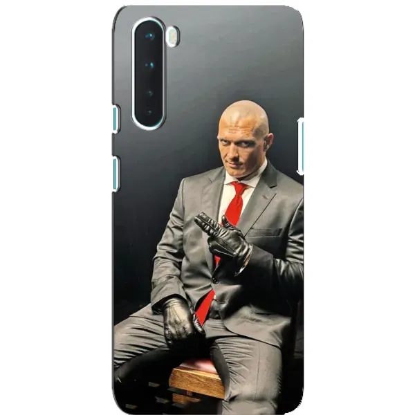 Чехол с принтом «Усик Hitman» для OnePlus Nord Чехол с принтом «Усик Hitman» для OnePlus Nord