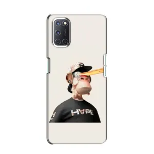 Чехлы с Обезьянами NFT для Oppo A52 (AlphaPrint) (обезьяна NFT в очках)