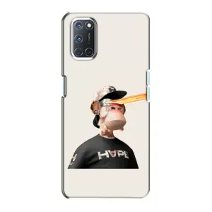 Чехлы с Обезьянами NFT для Oppo A72 (AlphaPrint) (обезьяна NFT в очках)