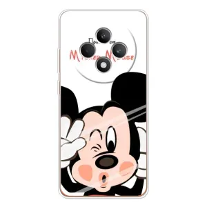 Эксклюзивный чехол для OPPO Reno 12 F (AlphaPrint - Мультяшные) (Маус Микки)