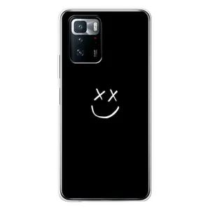 Чохол для Сяомі POKO X3 GT - (AlphaPrint) з принтом (ТОП продажів) (Смайл)