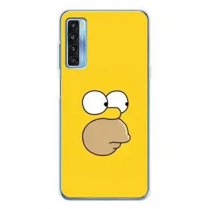 Чjхол з Сімпсонами для TCL 20L Plus (VPrint) (Гомер)