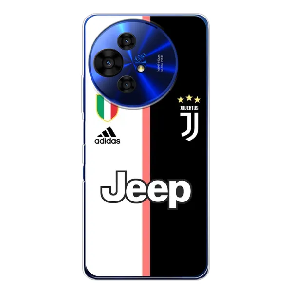 Чехол с принтом «Juventus» для TCL 50 NxtPaper Чехол с принтом «Juventus» для TCL 50 NxtPaper