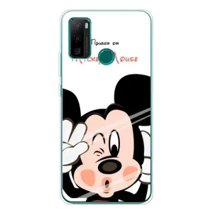 Эксклюзивный чехол для Ulefone Note 10P (AlphaPrint - Мультяшные) (Маус Микки)