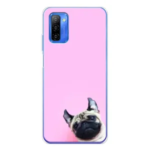 Чохли з собаками для Ulefone Note 12 (VPrint) (Смішна собака)