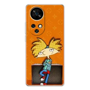 Бренднові Чохли для Ulefone Note 17 Pro - (PREMIUMPrint) (Арнольд)