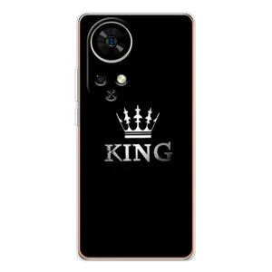 Чохол з Короною Нот 17 Про - (AlphaPrint) (KING)