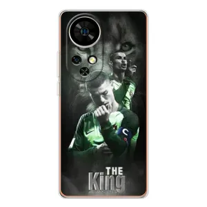 Чохол Кріштіану Роналду для Ulefone Note 17 Pro (AlphaPrint) (Крістіано Лев)