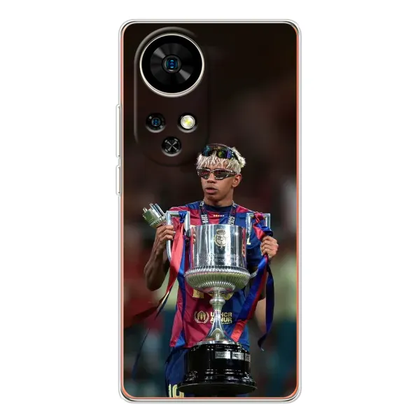 Чохол з принтом «Ямаль з кубком» для Ulefone Note 17 Pro Чохол з принтом «Ямаль з кубком» для Ulefone Note 17 Pro
