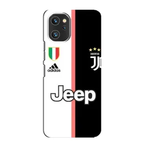Чохли для Umidigi A13 Pro (VPrint) - Футбольні клуби (Juventus)