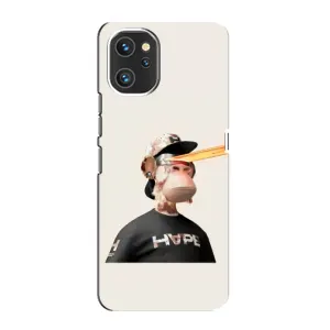 Чехлы с Обезьянами NFT для Umidigi A13 (AlphaPrint) (обезьяна NFT в очках)