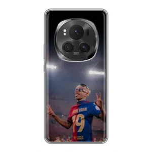 Чехол с футболистом Ламин Ямаль ViVO X200 PRO (Ямаль на стадионе)