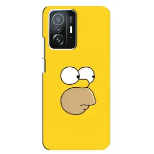 Чехол с принтом «Гомер» для Xiaomi 11T / 11T Pro