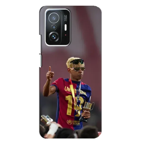 Чохол з принтом «Lamine Yamal» для Xiaomi 11T / 11T Pro