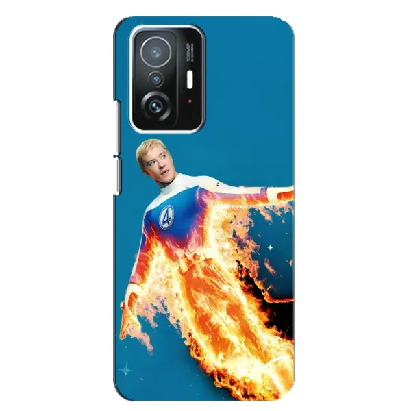 Чохол з принтом «Людина-факел у вогні» для Xiaomi 11T / 11T Pro Чохол з принтом «Людина-факел у вогні» для Xiaomi 11T / 11T Pro