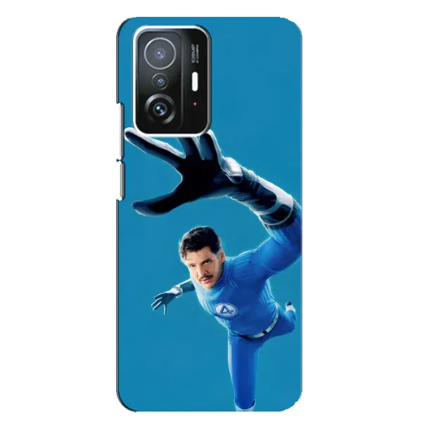 Чохол з принтом «Містер Фантастік супергерой» для Xiaomi 11T / 11T Pro Чохол з принтом «Містер Фантастік супергерой» для Xiaomi 11T / 11T Pro