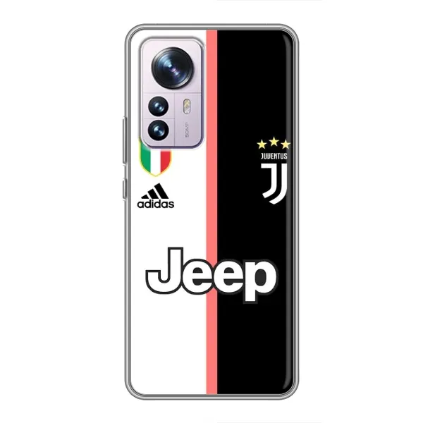 Чохол з принтом «Juventus» для Xiaomi 12 / 12X