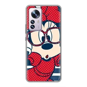 Эксклюзивный чехол для Xiaomi 12 / 12X (AlphaPrint - Мультяшные) (Маус в очках)