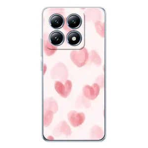 Чохол з розовим принтом для Xiaomi 14T Pro