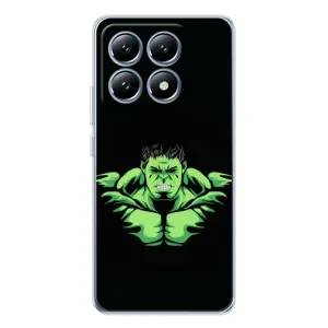 Чехлы с героями Марвел Xiaomi 14T Pro (VPrint) (Зелёный Халк)