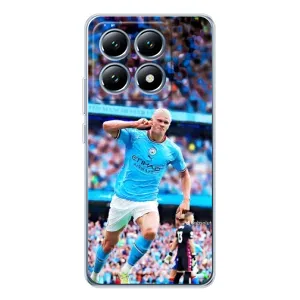 Чехлы с футболистом Ерлинг Холанд для Xiaomi 14T (AlphaPrint) (фанаты Холанда)