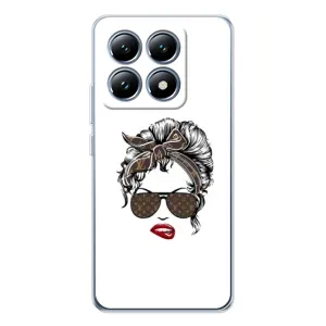 Чохли Луі Вітон для Xiaomi 14T (AlphaPrint - LOUIS VUITTON) (стильна з луі вітон)