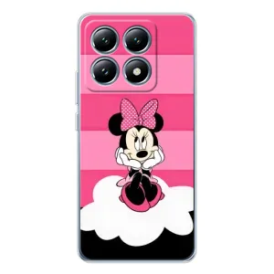 Эксклюзивный чехол для Xiaomi 15 Pro (AlphaPrint - Мультяшные) (Девочка Maus)
