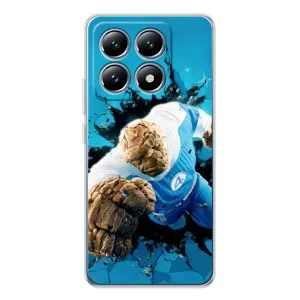 Чохол з принтом Фантастична четвірка для Xiaomi 15 Pro (Істота Фантастична Четвірка)