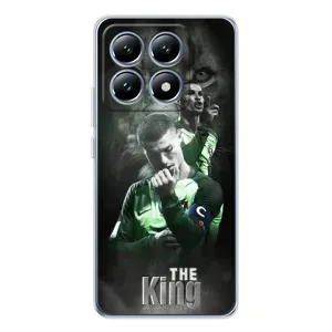 Чохол Кріштіану Роналду для Xiaomi 15 Pro (AlphaPrint) (Крістіано Лев)