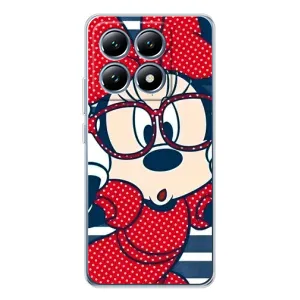 Эксклюзивный чехол для Xiaomi 15 Pro (AlphaPrint - Мультяшные) (Маус в очках)