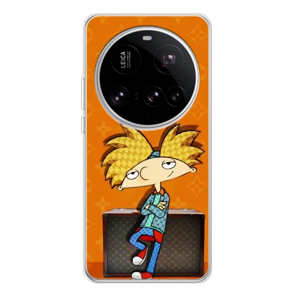 Чехол с принтом «Арнольд» для Xiaomi 15 Ultra